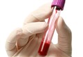 Ask the Doc: 'I may need a blood test - what does that involve?'