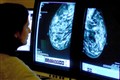About 4,000 women with breast cancer could benefit from new twice-daily pill
