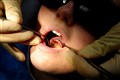 Plan to improve dental delays by granting hygienists more power