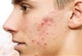 ASK THE DOC: 'My son is developing acne - is there anything you can suggest to help?'