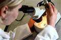 Risk of melanoma may be gauged long before suspicious moles appear – study