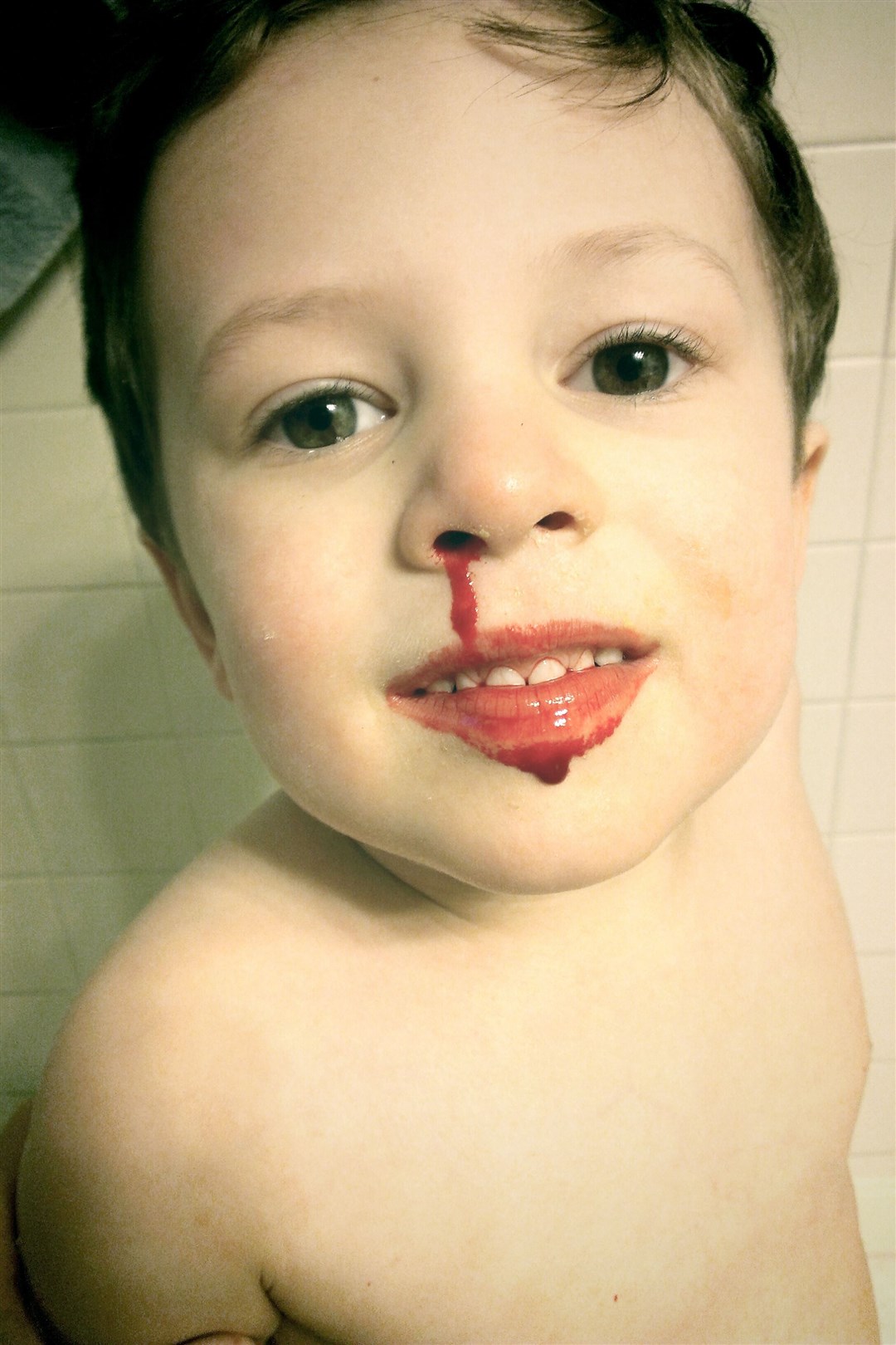 Nose bleeds can be common in children. Picture: Ragesoss, via Wikimedia Commons.