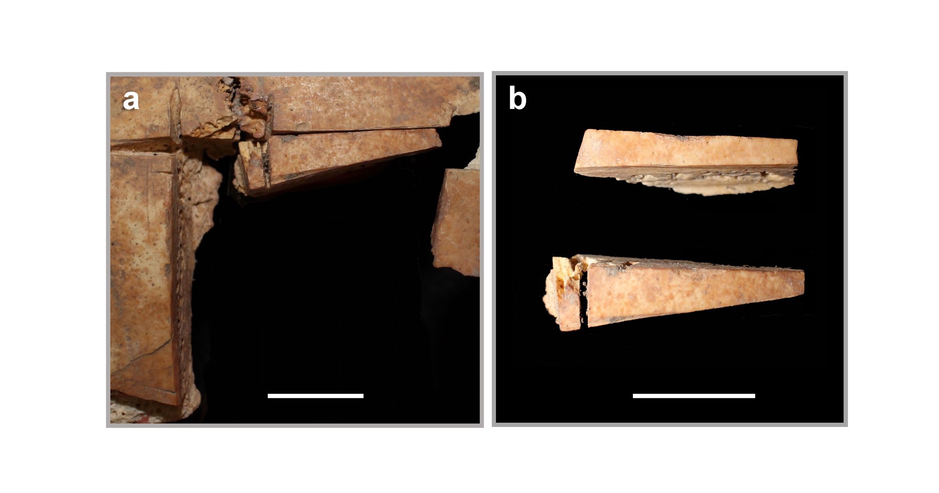 A closer look at the skull from where a piece of bone was surgically removed (Kalisher et al/Plos One/PA)