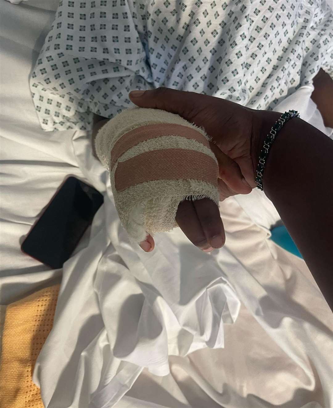 Raheem Bailey had his finger amputated (PA)