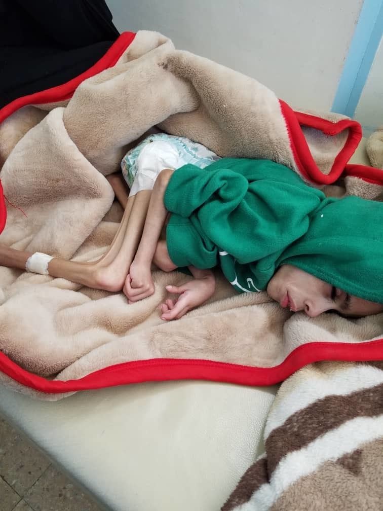 Children and families in the hospital in Yemen.
