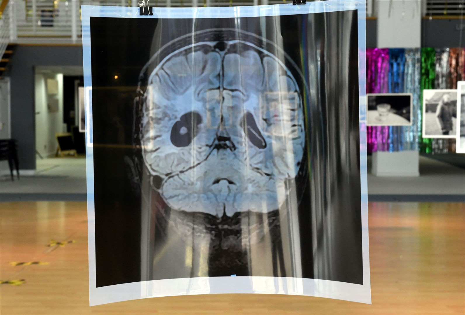 Brain scan image. Picture: James Mackenzie.